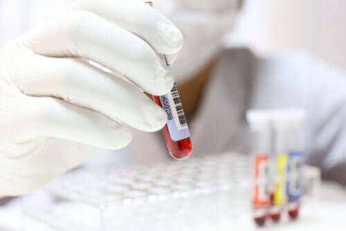 Снимка на лекар, който прави кръвен тест