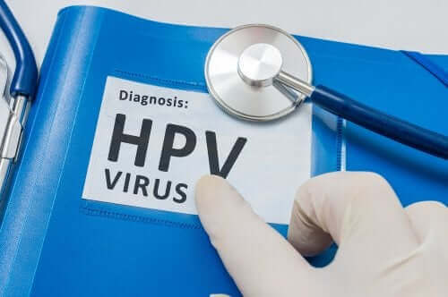 Човешкият папилома вирус: знак с тази диагноза на английски език