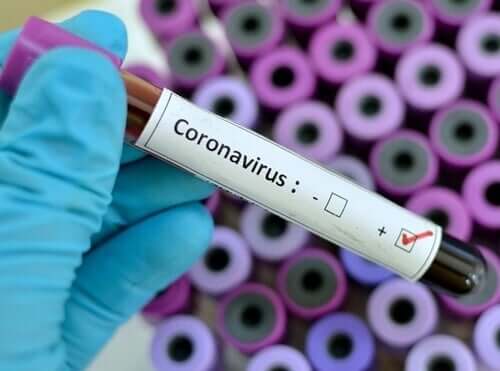 Запазете спокойствие, за да се справите адекватно с епидемияга на коронавируса