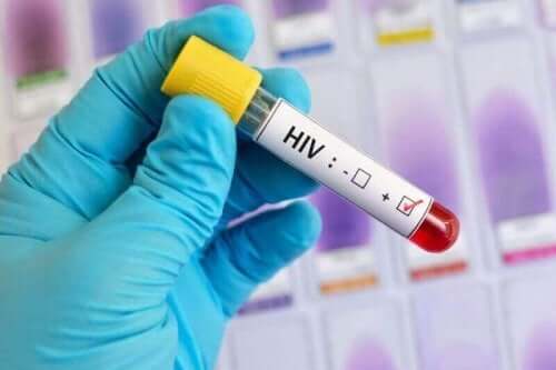 тестване за ХИВ/СПИН