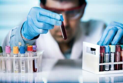 Хората с HIV: Лекар държи една епруветка за тестване