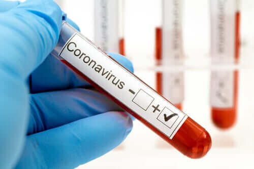 Кръвен тест за коронавирус