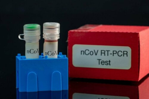 PCR тестът е основният метод за откриване на коронавируса.