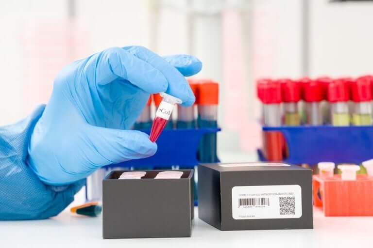 Откриване на коронавируса: какво представлява PCR тестът?