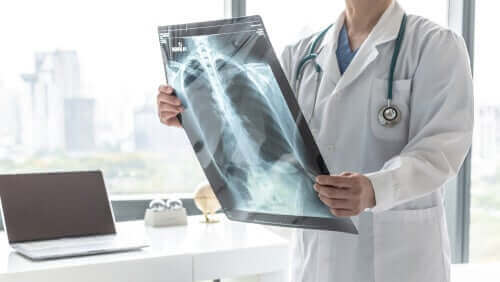 Рентгенова снимка на бял дроб