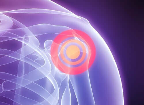 Разкъсването на раменната става: схема на болка в рамото