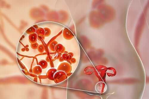 Микоплазма гениталиум: причини, симптоми и лечение