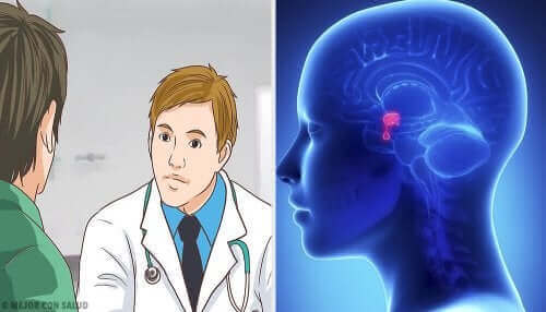 Хипофизната аденома: колаж от две снимки на заболяването и на рисунка на лекар и пациент