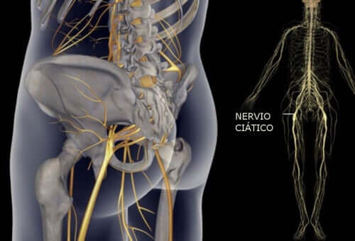 Лесни упражнения за облекчаване на болката в седалищния нерв