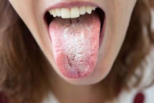 Тъмните петна по езика се появяват поради различни причини.