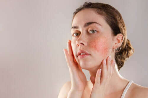 Реактивната кожа: симптоми, причини и лечение
