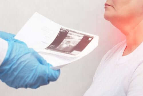 Възлите на щитовидната жлеза: Симптоми и причини