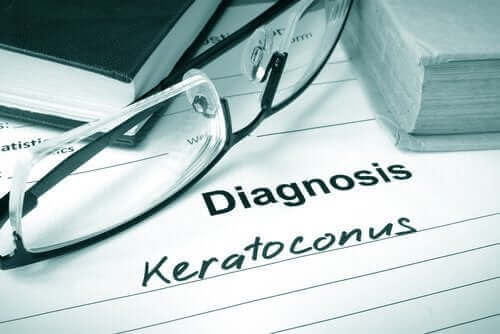 Кератоконус: характеристики и лечение