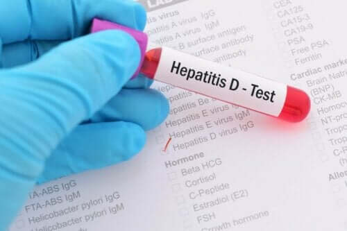 Тест за хепатит D