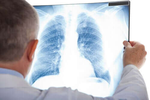 Лекар разчита рентгенова снимка