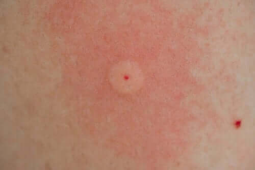 Ужилване от стършел