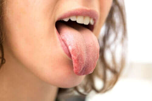 Защо хората с диабет се оплакват от сухота в устата?