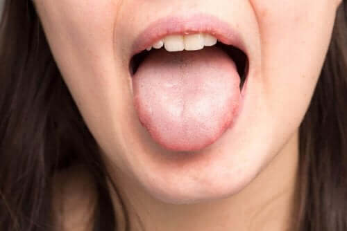 Плътна слюнка: жена изплезила побелял език