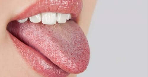 Пареща уста: снимка на бял език