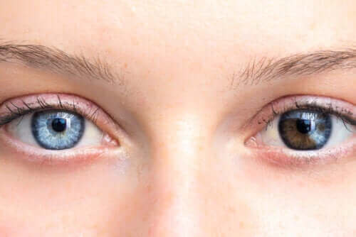 Промените в цвета на очите могат да бъдат притеснителни