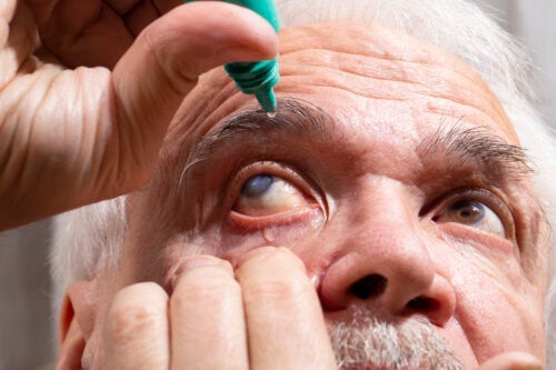 Какво представляват очните капки пилокарпин и кога се препоръчват?