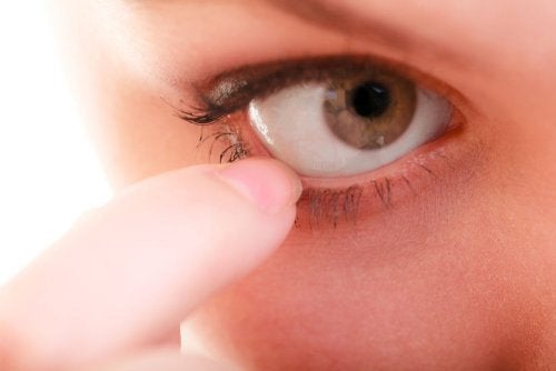 10 естествени лека за сърбеж в очите