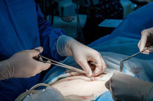 Присаждането на кожа: кога се прилага?