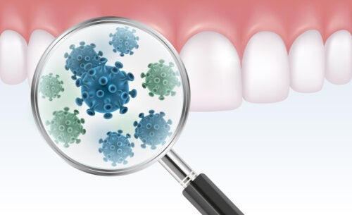 Всичко, което трябва да знаете за зъбната бактериална плака