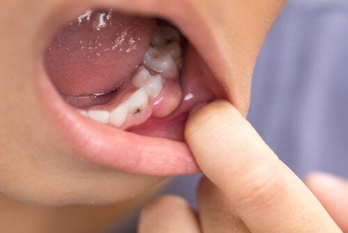Симптоми на зъбна инфекция, която се е разпространила в тялото